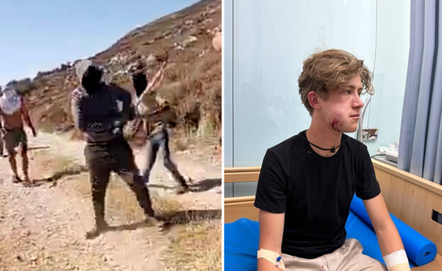 מתנחלים תקפו באלות מתנדבים אמריקנים שסייעו לפלסטינים…