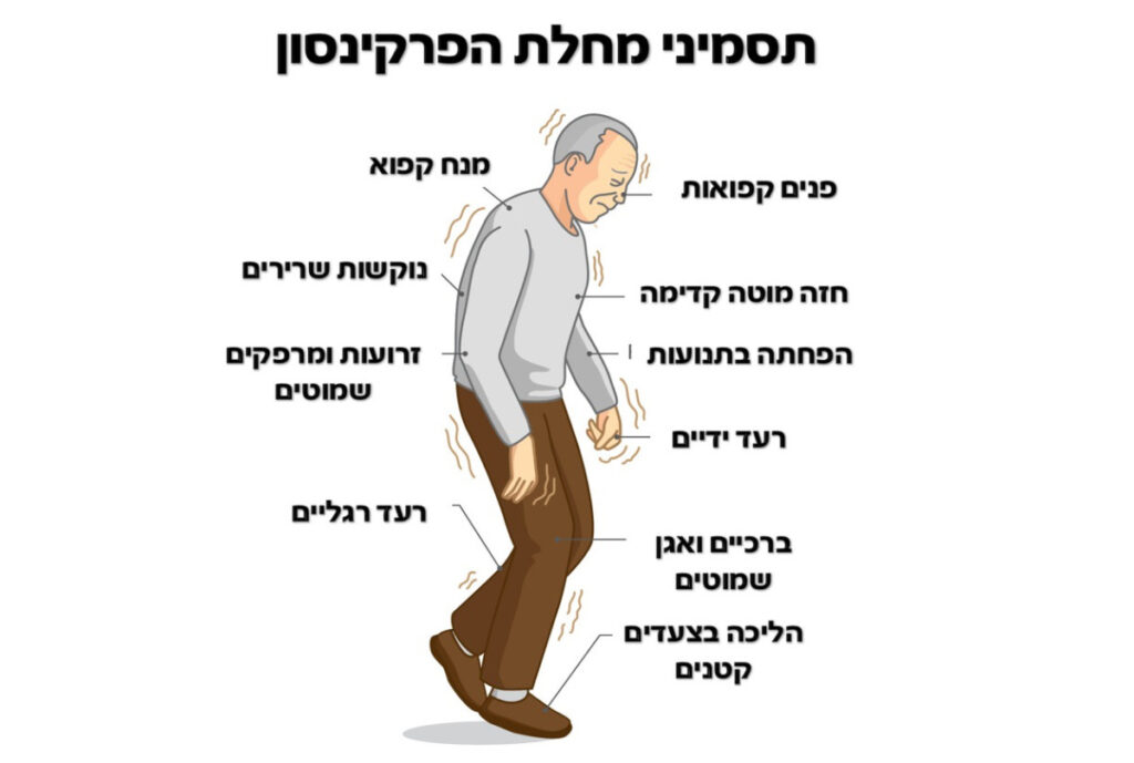 בעקבות הווידוי של שמואל וילוז'ני: כל מה שצריך לדעת על פרקינסון